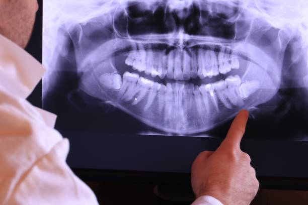 Best Emergency Wisdom Teeth Removal in Dysart, IA
