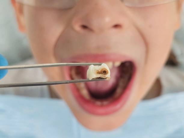 Best Pediatric Emergency Dentist in Dysart, IA